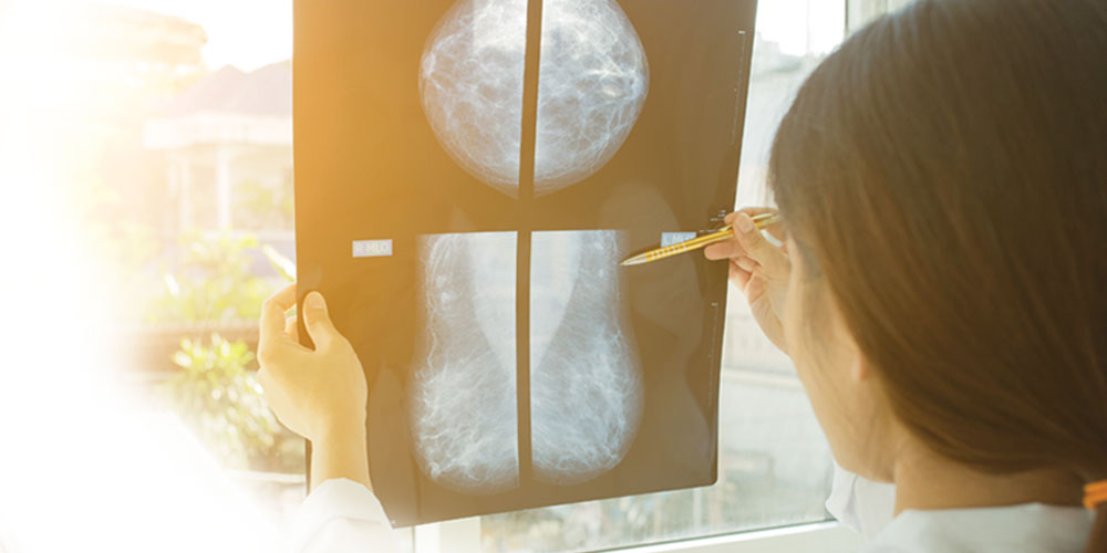 Detección y tratamiento del cáncer de mama